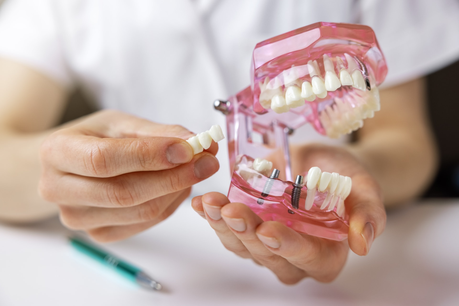 Curso Implantologia Periodoncia Posgrado