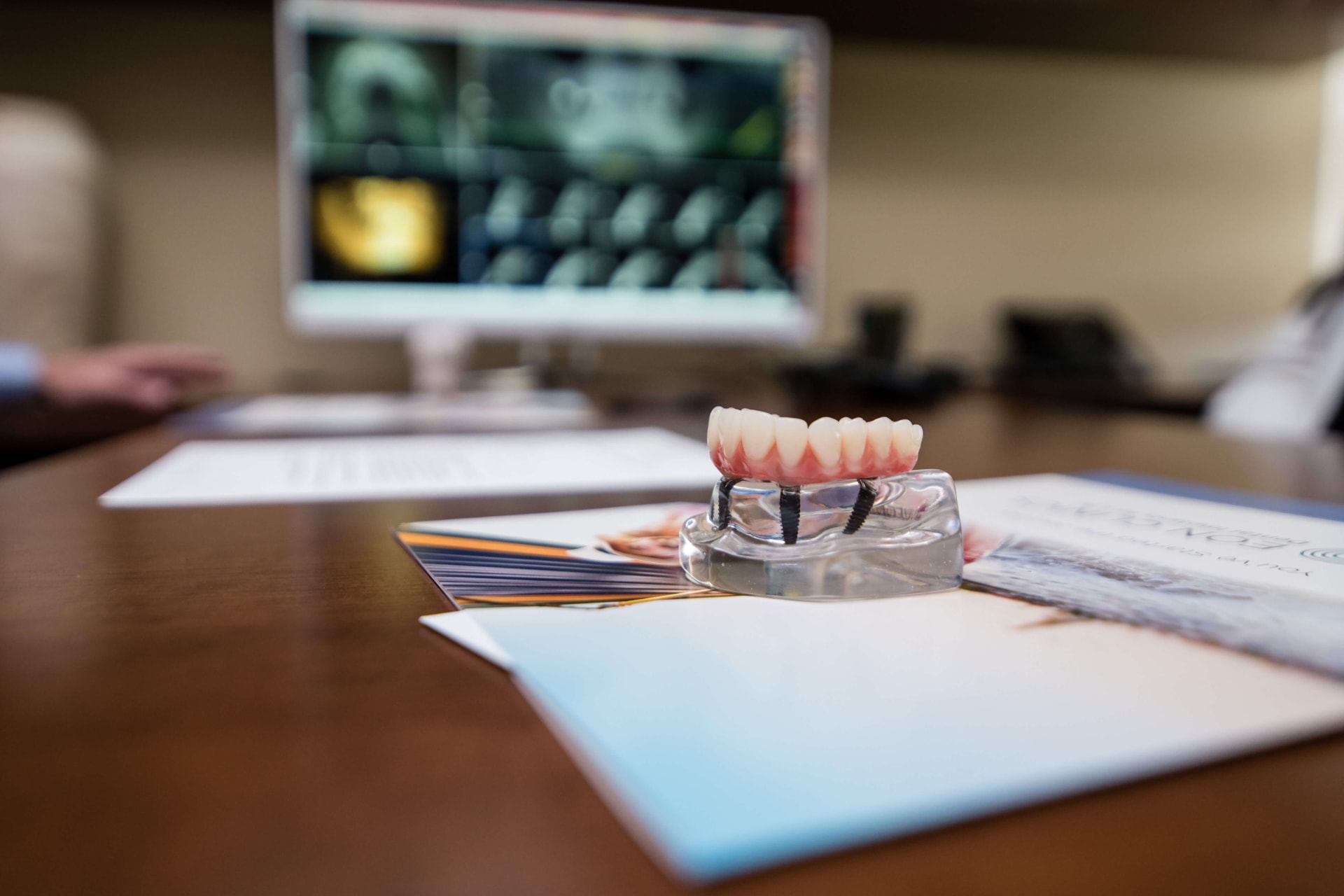 Curso Implantoprotesis Clinica Posgrado