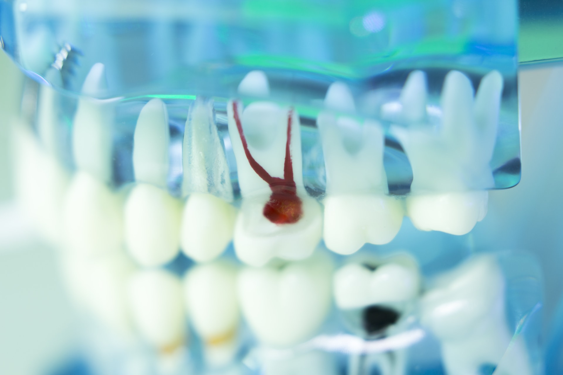 Curso Odontologia Conservadora Posgrado